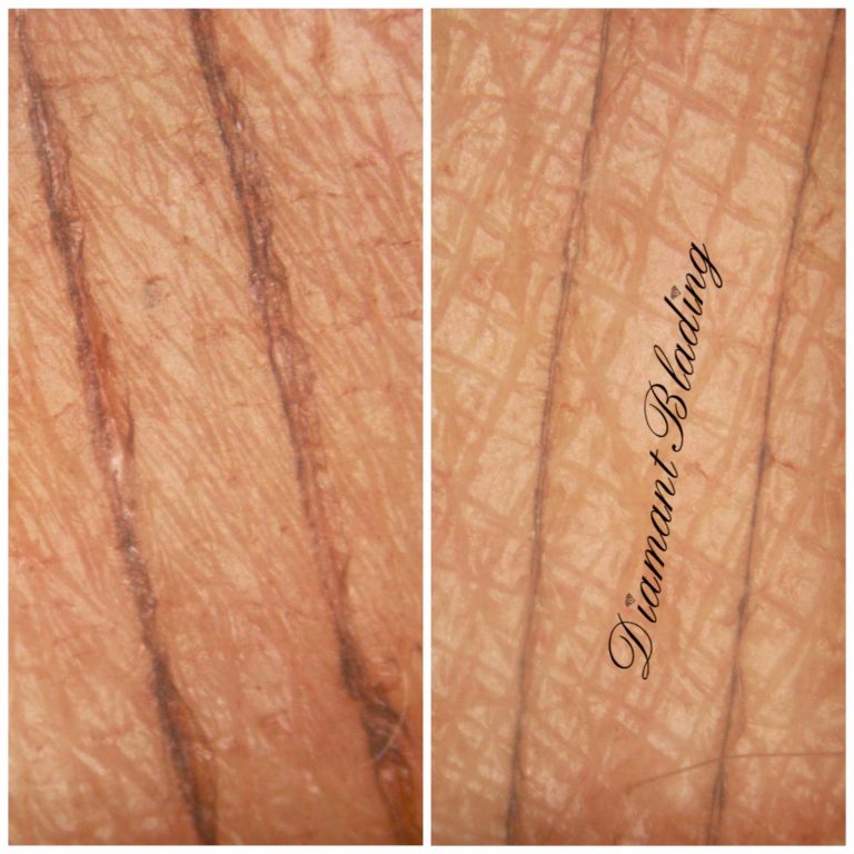 vorher-nachher-diamant-blading
