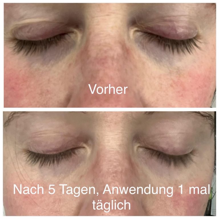 Hautpflegeberatung-Emmendingen-1