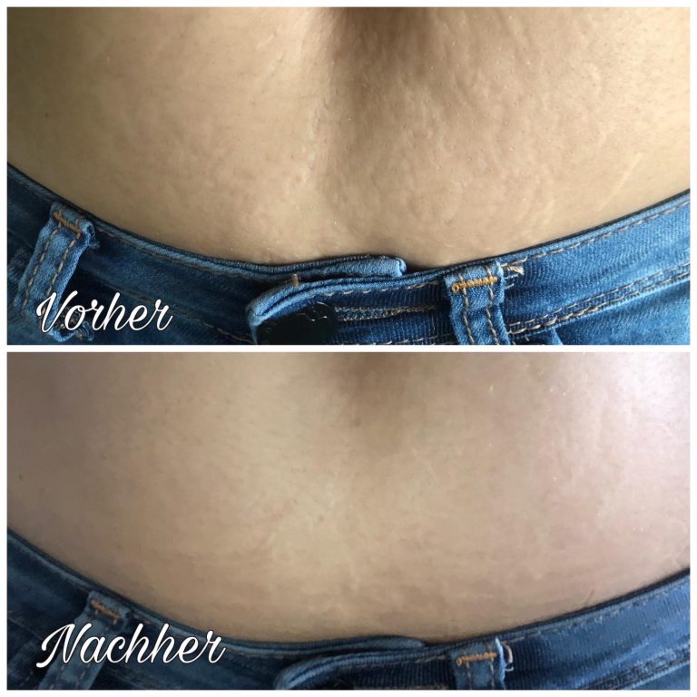 Hautpflegeberatung-Emmendingen-3